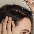 Medications for Hair Regrowth: The Key to a Healthier Future