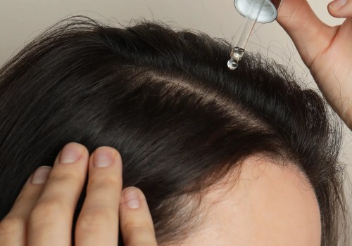 Medications for Hair Regrowth: The Key to a Healthier Future