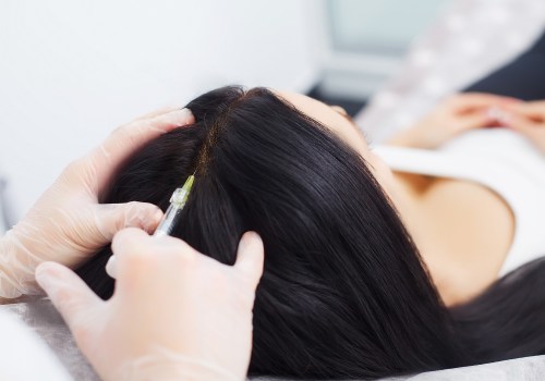 Surgical Options for Hair Restoration: A Comprehensive Guide