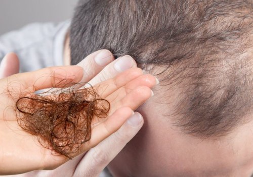 Understanding Medical Conditions That Can Cause Hair Loss